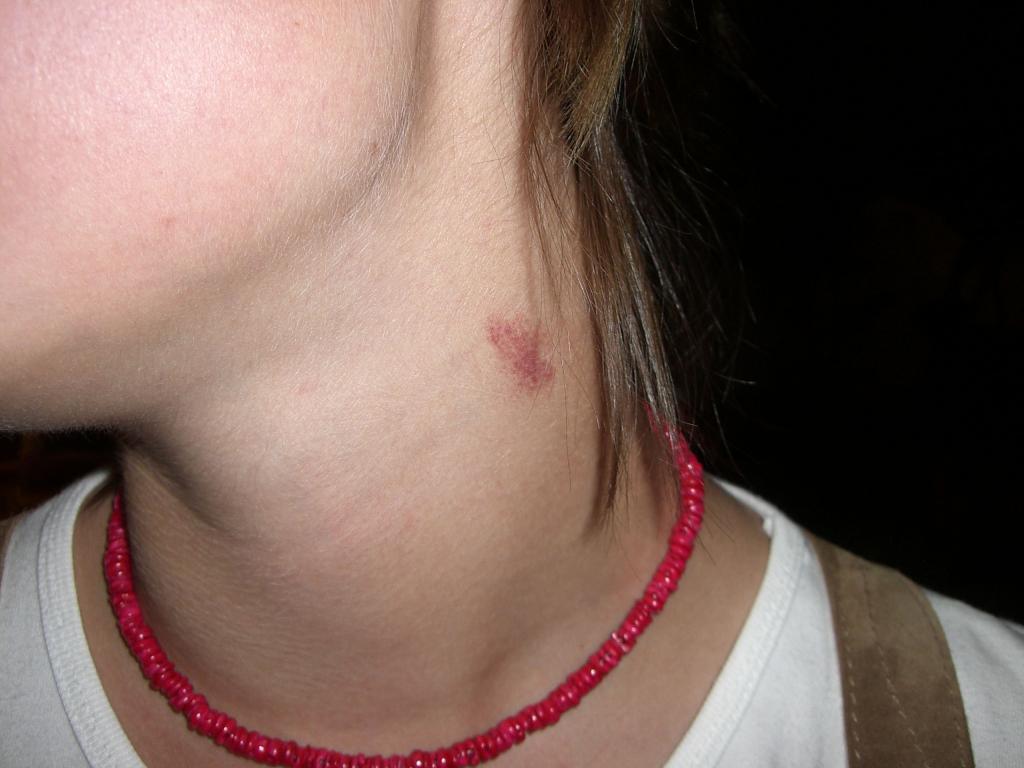 Bild vergr&ouml;ssern